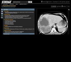 STATdx - Diagnostic Decision Support for Radiology - Paid Files ...