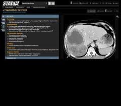 More information about "STATdx - Diagnostic Decision Support for Radiology"
